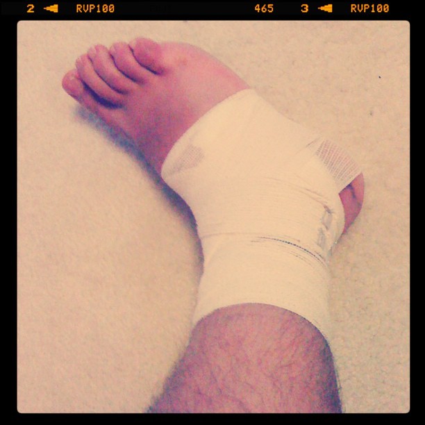 Sprained Ankle (sad face) [pic]